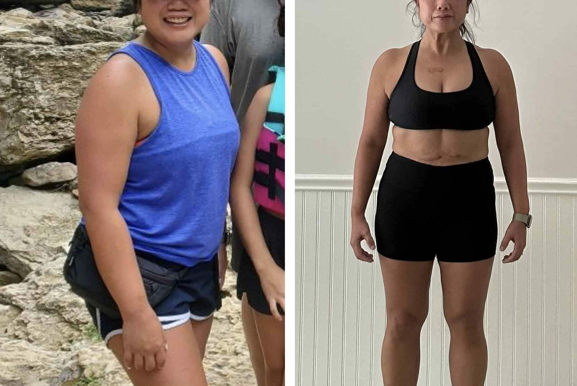 Debbie, 20lbs in 16 weeks, Dermatologist